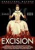 Excision